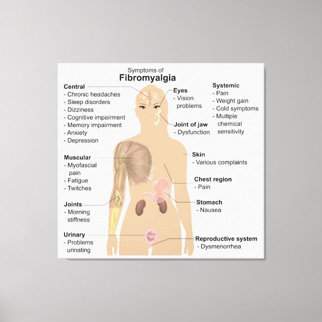 Chart Signs Symptoms Fibromyalgia Canvas Print (Front)