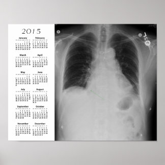 Chest X Ray calendar ~ Poster