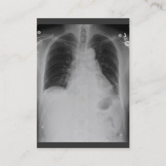 Chest X Ray ~ Chubby Business Card