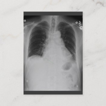 Chest X Ray ~ Chubby Business Card by Andy2302 at Zazzle