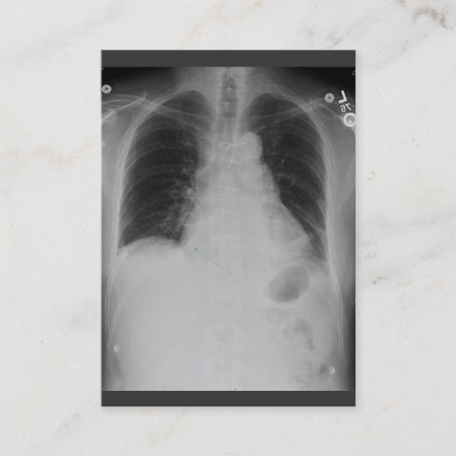 Chest X Ray ~ Chubby Business Card (Front)