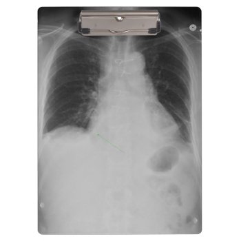Chest X Ray ~ Clipboard by Andy2302 at Zazzle