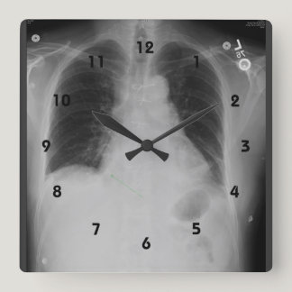 Chest X Ray ~ Clock