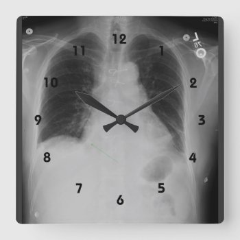 Chest X Ray ~ Clock by Andy2302 at Zazzle