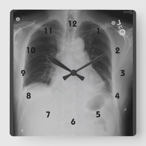 Chest X Ray  Clock