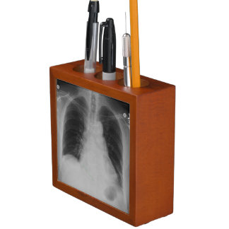 Chest X Ray ~ Desk Organizer