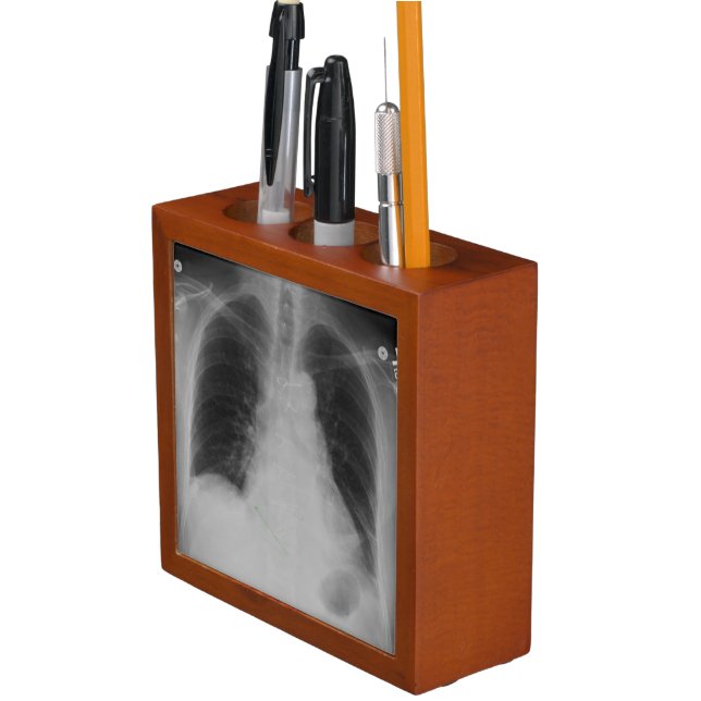 Chest X Ray ~ Desk Organizer (In Situ)