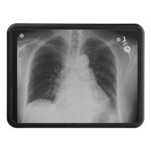 Chest X Ray ~ Hitch cover