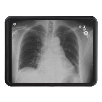 Chest X Ray ~ Hitch Cover by Andy2302 at Zazzle