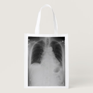Chest X Ray ~ Poly bag