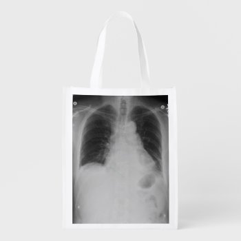 Chest X Ray ~ Poly Bag by Andy2302 at Zazzle