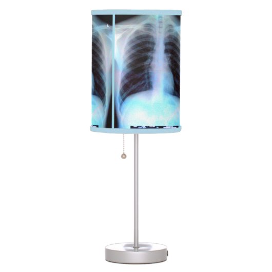 Chest Xray Rib-cage Lamp (Right)
