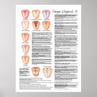 Chinese Tongue Diagnosis Acupuncture Poster