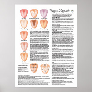 Chinese Tongue Diagnosis Acupuncture Poster