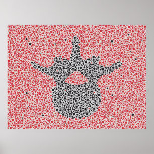 Chiropractic Anatomy Artwork Lumbar Vertebrae Poster