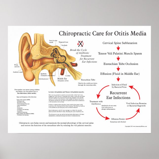 Chiropractic Care for Otitis Media Ear Infections Poster (Front)