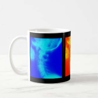 Chiropractic Coffee Cup, Travel Mugs, and Steins