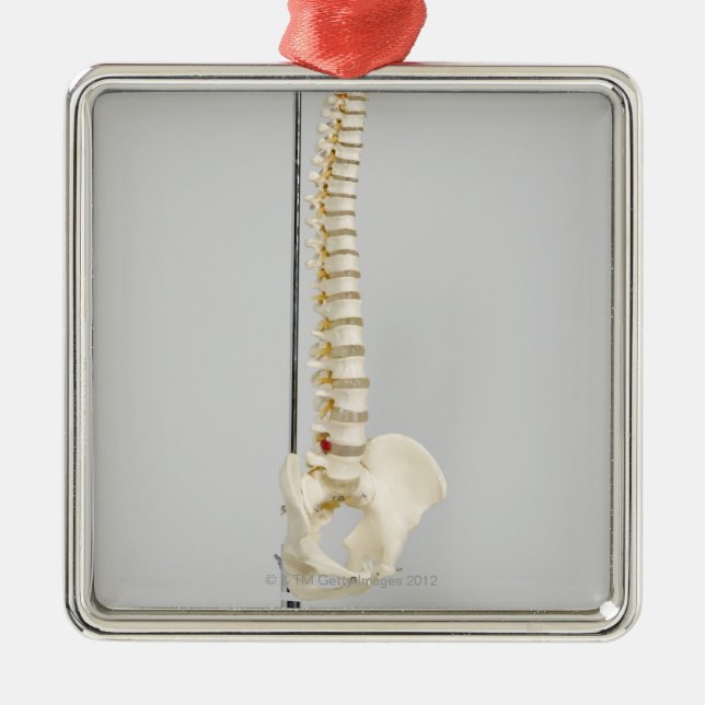 Chiropractic skeleton metal ornament (Front)