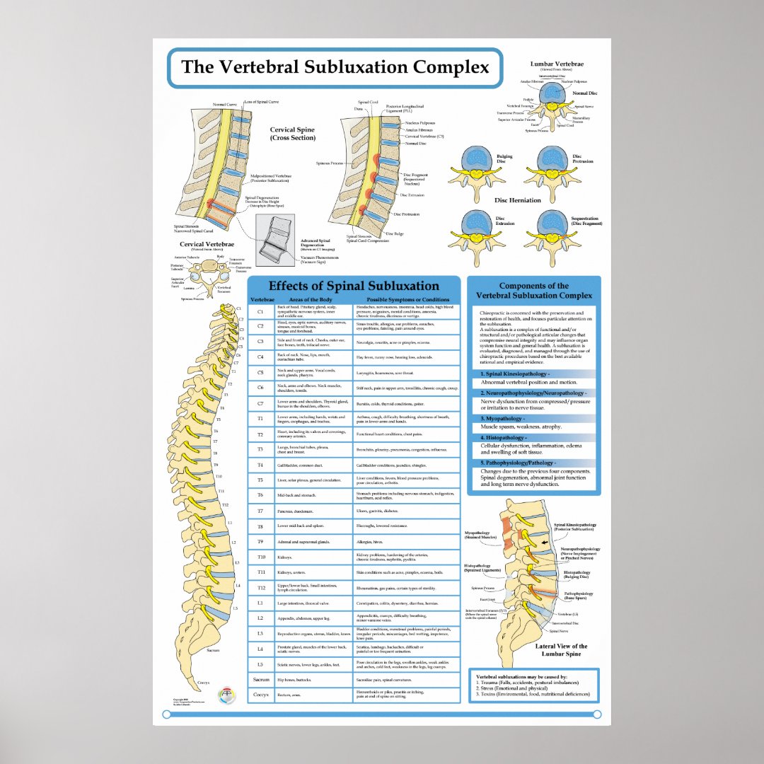 Chiropractic Vertebral Subluxation Complex Poster | Zazzle