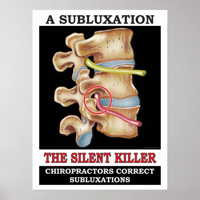 Chiropractic Vertebral Subluxation Poster (Front)