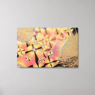 Cholesterol crystals 2 canvas print
