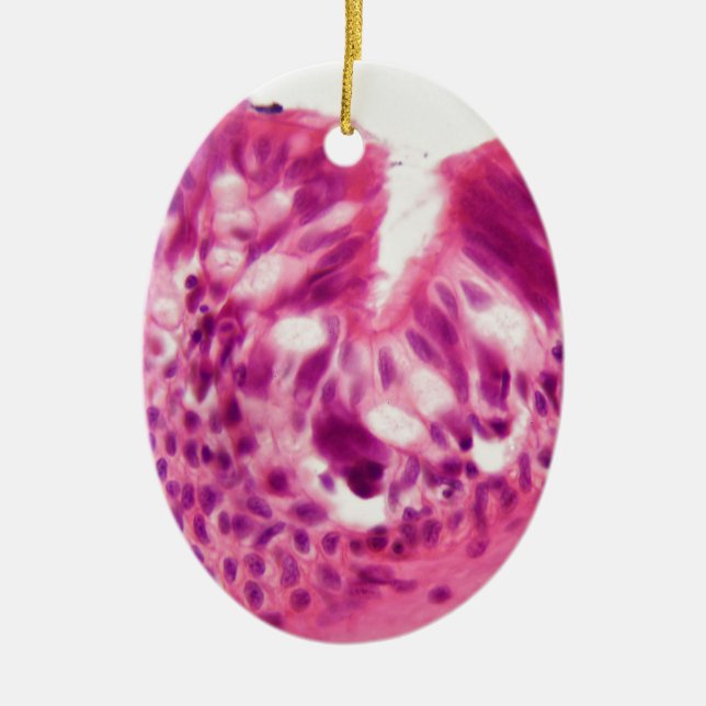 Ciliated epithelium under the microscope. ceramic ornament (Front)