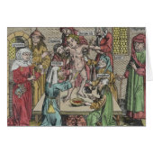 Circumcision (Front Horizontal)