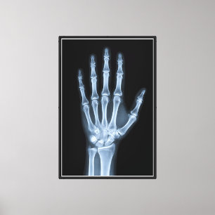 Clinical X-Ray Hand Canvas Print