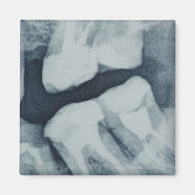 Close-up of a dental X-Ray Magnet (Front)