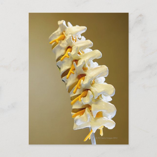 Close-up of a medical model of vertebrae of the postcard (Front)