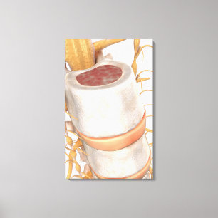 Close up of an invertebral disc in the spine canvas print