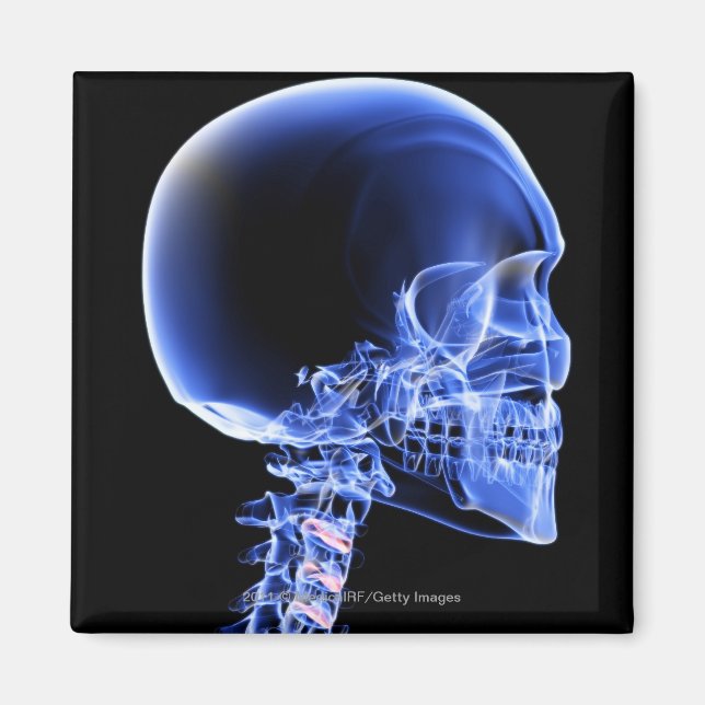 Close up x-ray of the bones in the neck magnet (Front)
