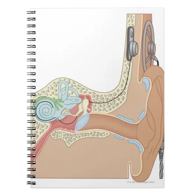 Cochlear Implants Notebook | Zazzle