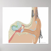 Cochlear Implants Poster | Zazzle