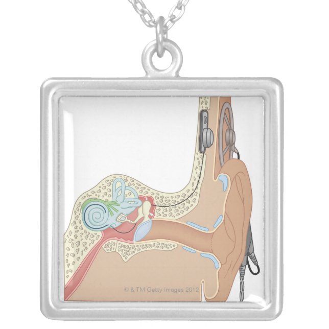 Cochlear Implants Silver Plated Necklace (Front)