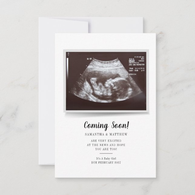 Coming Soon Script Ultrasound Photo Pregnancy (Front)