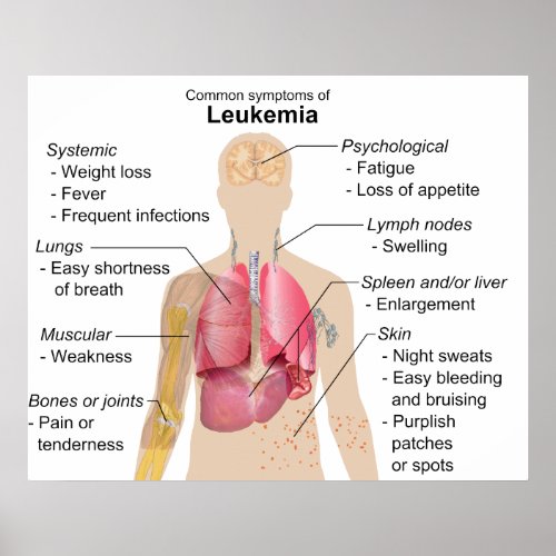 Common Symptoms Chart of Leukemia Blood Cancer