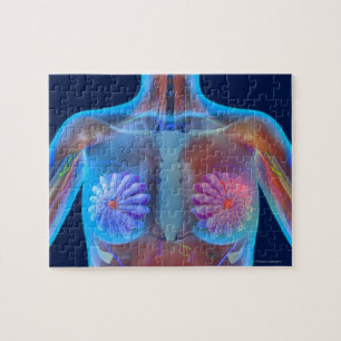 Computer artwork representing breast cancer, jigsaw puzzle