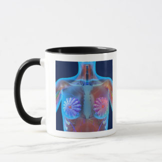 Computer artwork representing breast cancer, mug