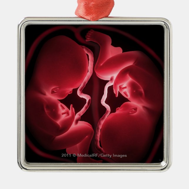 Conceptual image of a womb containing twins metal ornament (Front)