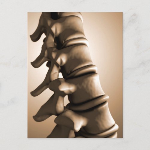 Conceptual Image Of Human Backbone 4 Postcard