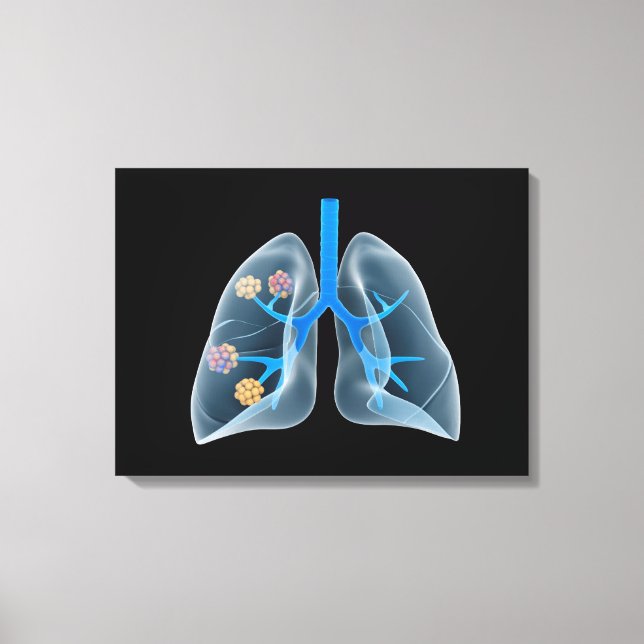 Conceptual Image Of Human Heart 4 Canvas Print (Front)