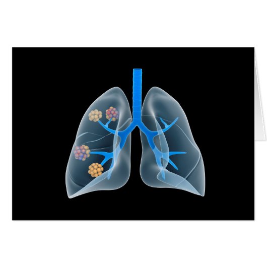 Conceptual Image Of Human Heart 4 Cards (Front Horizontal)