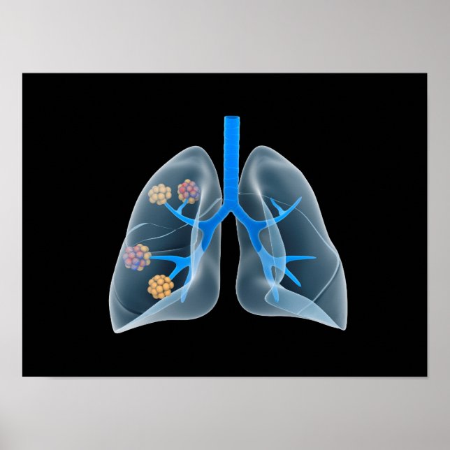 Conceptual Image Of Human Heart 4 Poster (Front)