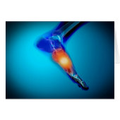 Conceptual Image Of Pain In Human Foot (Front Horizontal)
