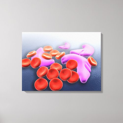 Conceptual Image Of Sickle Cell Anemia Canvas Print