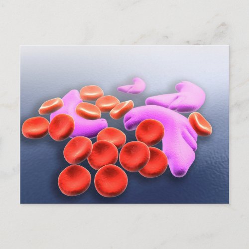 Conceptual Image Of Sickle Cell Anemia Postcard