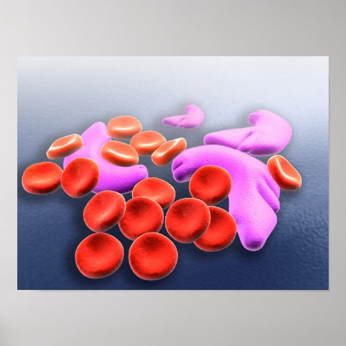 Conceptual Image Of Sickle Cell Anemia Poster