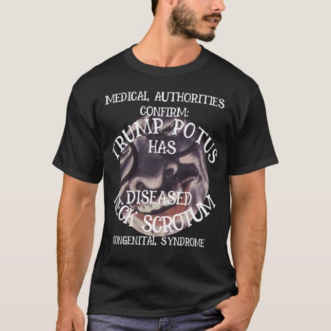 CONFIRMED TRUMP HAS NECK SCROTUM SYNDROME T-Shirt (Front)