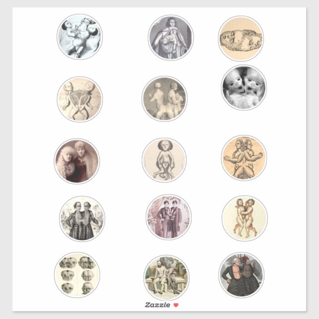 Conjoined Siamese Twins Sideshow Freaks Pics Art Sticker (Sheet)